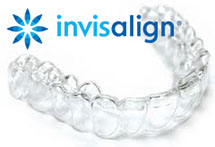 Jest to system przezroczystych nakładek na zęby, zaprojektowanych i wykonanych indywidualnie dla każdego pacjenta.